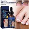 Cure Ingrown Toenail Treatment Infection Nail Care Oil Removals Paronychias