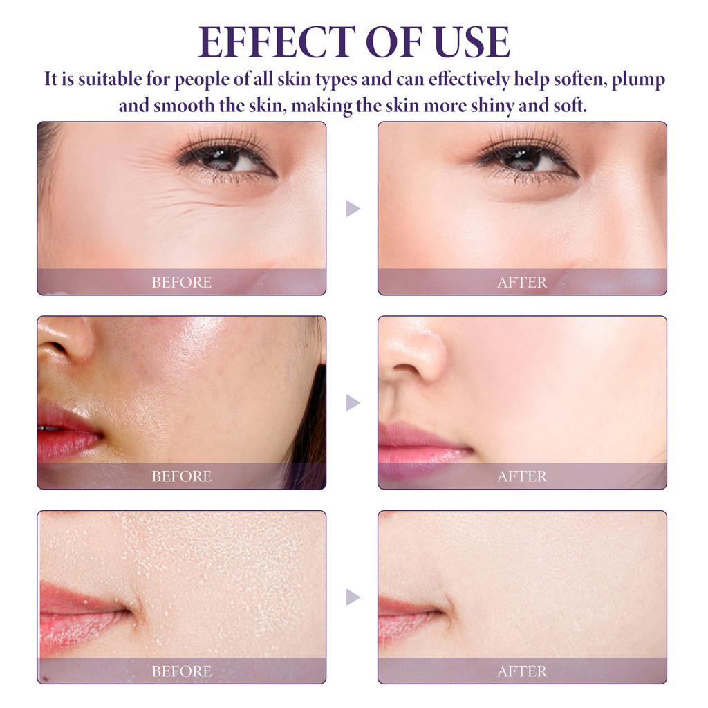 Oceaura Hyaluronic Acid Facial Serum For Hydration Firming Wrinkle Reduction And Pore Minimizing 50ml