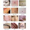 Ultrasonic Freckle Spots Removal Machine Detoxifying Face Care Machine for Home SalonUS Plug 110V