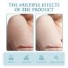Ouhoe Moisturizing Cooling Cream For Deep Hydration And Soothing Relief From Sunburn And Dry Skin In 200g Packaging
