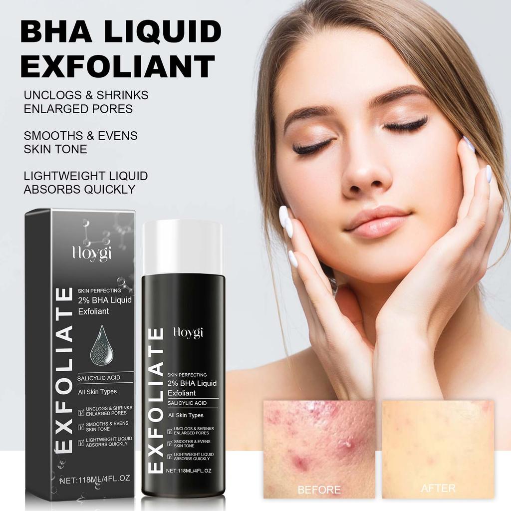 Hoygi Salicylic Acid Acne Clear Serum, Improves Acne, Fades Acne Marks, Tightens Pores, and Moisturizes the Skin. Suitable for the Face, 118ml