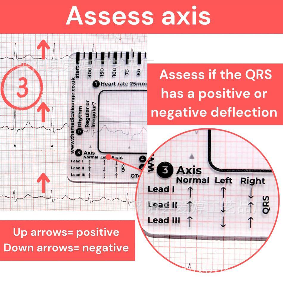 New Practical Portable ECG 7-Step Measuring Ruler