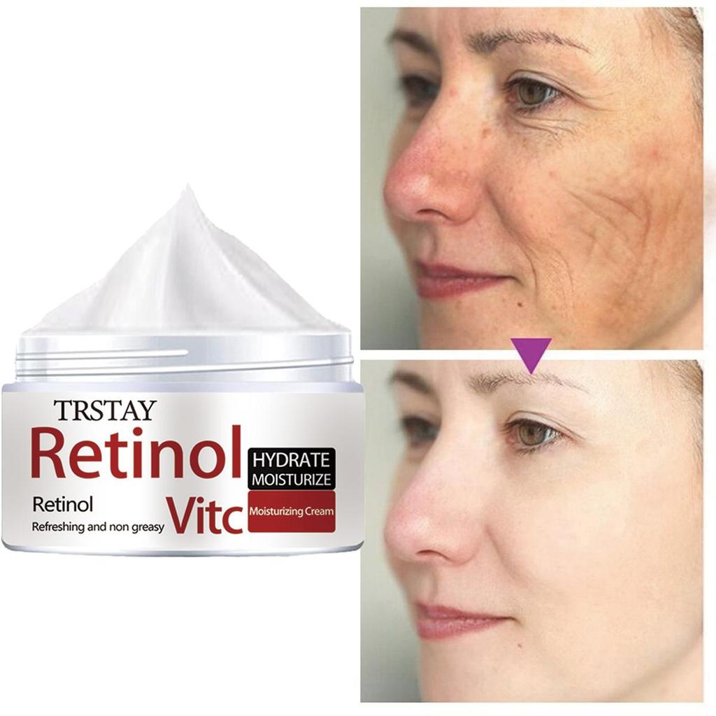 Hyaluronic Acid Cream, Moisturizing and Hydrating, Reducing Collagen Loss, Rejuvenating the Skin, Smoothing Wrinkles