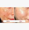 DERMA FACTORY Tranexamic Acid 6% Cream 30 Ml — Brightening & Pigmentation-Correcting Moisturizer
