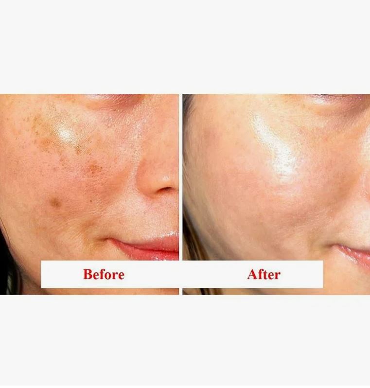 DERMA FACTORY Tranexamic Acid 6% Cream 30 Ml — Brightening & Pigmentation-Correcting Moisturizer