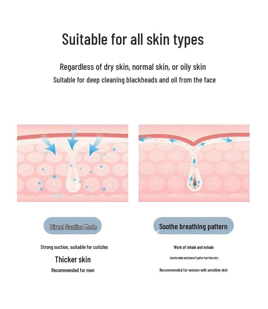 Electric Blackhead Remover & Pore Cleanser - Deep Cleanse Acne Device for Salons