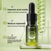 Plant Extract Acne Removal Cream Anti-Acne Repair Redness Pimple Spots Deep Cleaning Pore Oil Control Moisturizing Skin Care