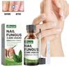 Conjunto Avançado Ximonth para Reparação de Unhas dos Pés e das Mãos para Cuidado de Unhas Saudáveis e Bonitas