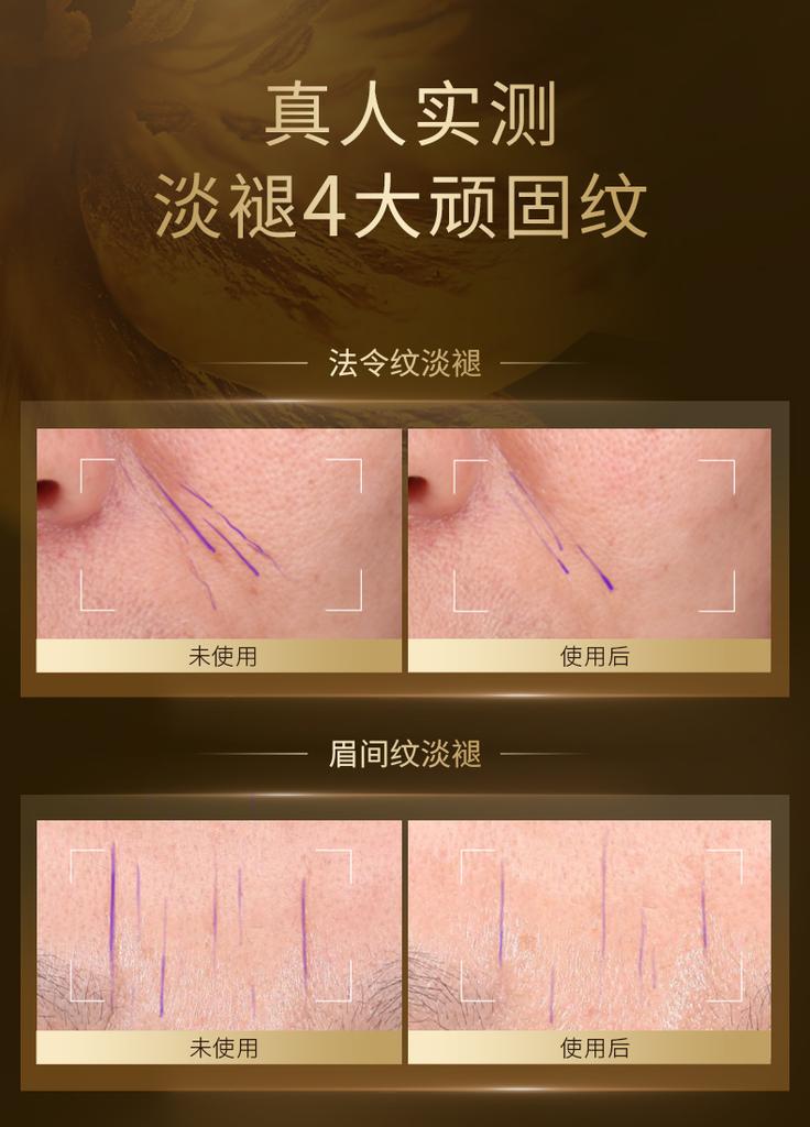 [Black Gold Water Cream] Lin Qingxuan Time Water Cream Set Anti Wrinkle, Tightening, Light Lines, Brightening and Repairing Selection Set