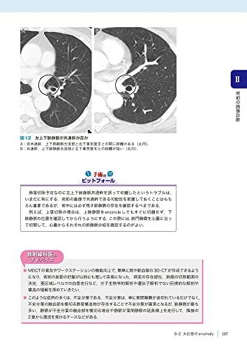 Chest Imaging and Thoracic Surgery