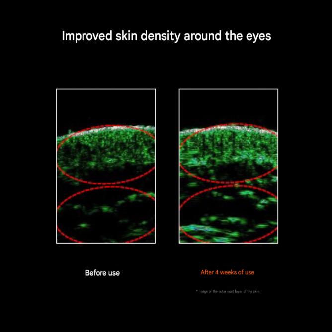 Sulwhasoo Concentrated Ginseng Renewing Eye Cream 15ml+3mlx5