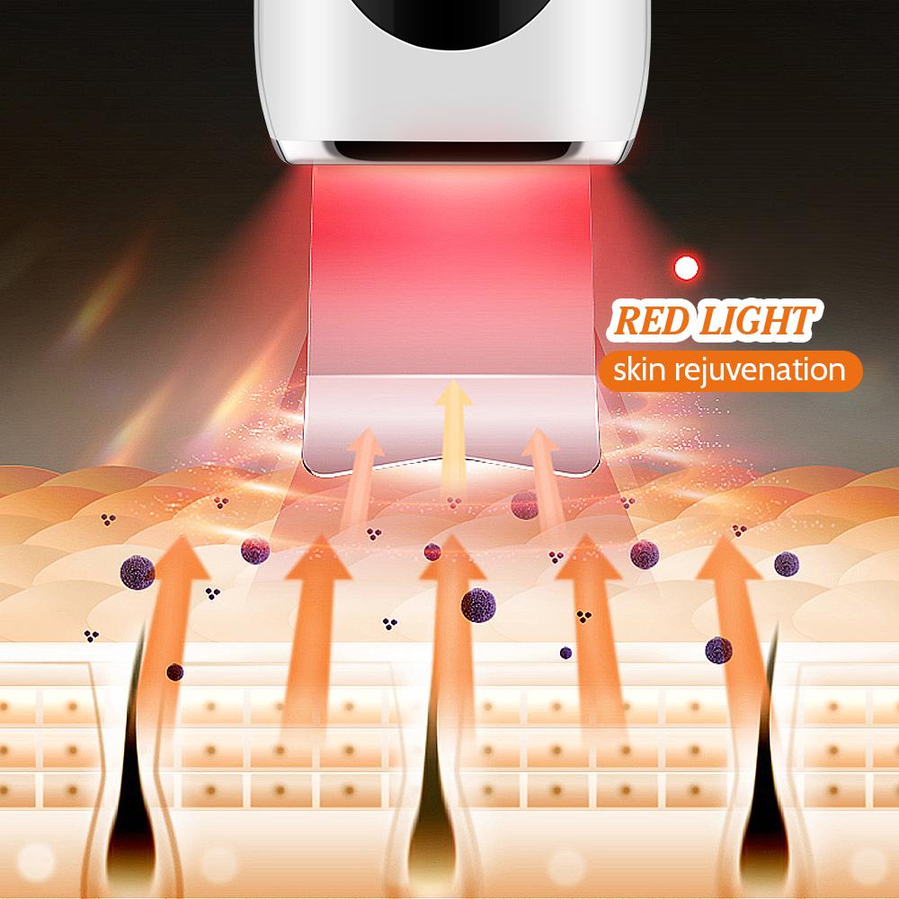 Ultrasonic Skin Scrubber Peeling Blackhead Remover Deep Face Cleaning Ultrasonic Ion Ance Pore Cleaner Facial Shovel Cleanser