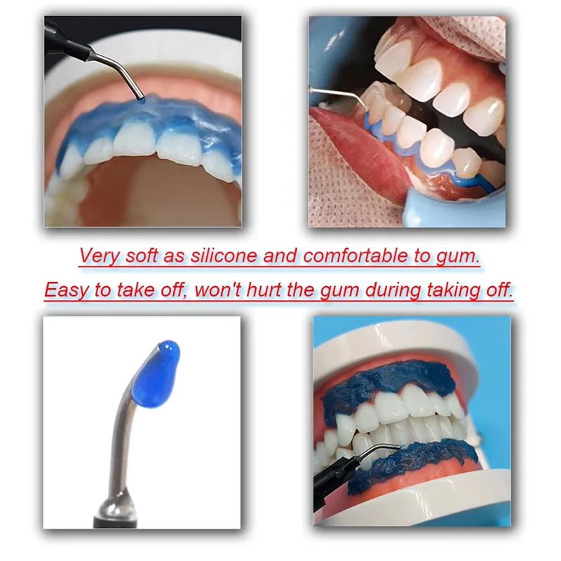 Gel Cura Riparazione Gengive Allevia Gengive Doloranti Migliora Infiammazione Gengivale Danneggiata Pulizia Macchie sui Denti Tartaro Sbiancante Gel Protettivo Gengive