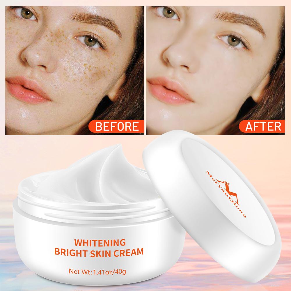 Anti-Freckle Whitening Cream with a Moisturizing Effect 40g face cream Beauty Qiong