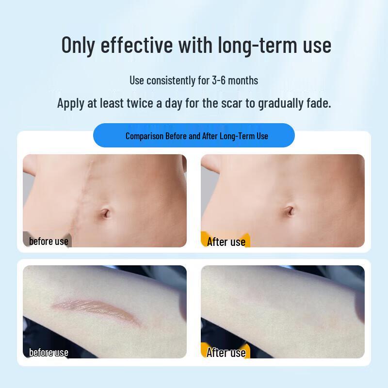 Ogas Medical Silicone Scar Repair Gel
