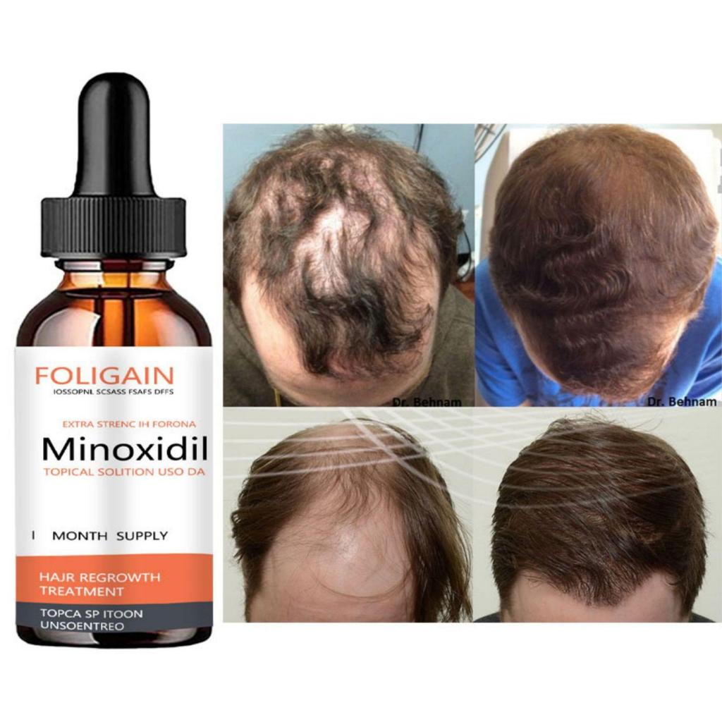 Liquide de soin hydratant pour la croissance des cheveux Favorise la croissance des cheveux, prévient la chute des cheveux, épaissit les cheveux Huile essentielle de soin