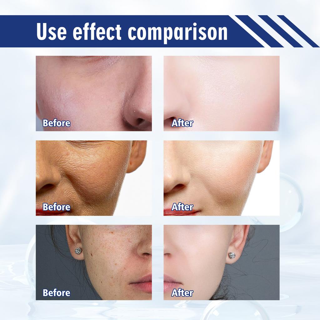 Niacinamide Whitening Spot Lightening Essence Whitening Skin Dark Spot Removing Nourishing and Hydrating Essence