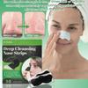 Blackhead Nose Strips, 30 pcs