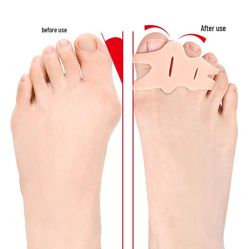 Drei-Zehen-Hallux-Korrektor-Hülle - Weiches Anti-Reibungs-Zehentrenner-Pad