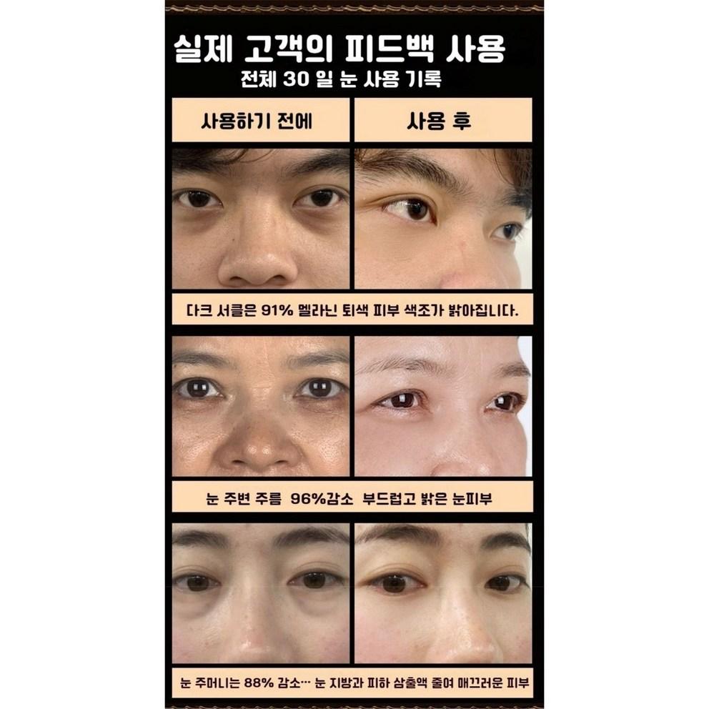 Eye Cream for Under Eye Bags Lifting, Dark Circles, Wrinkles, and Volume Improvement (20ml)