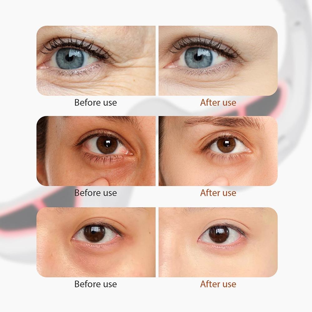 Micro-Current Eye Massager Electric Massager EMS Eye Relax Eye Care Machine  Eye Bag Removal