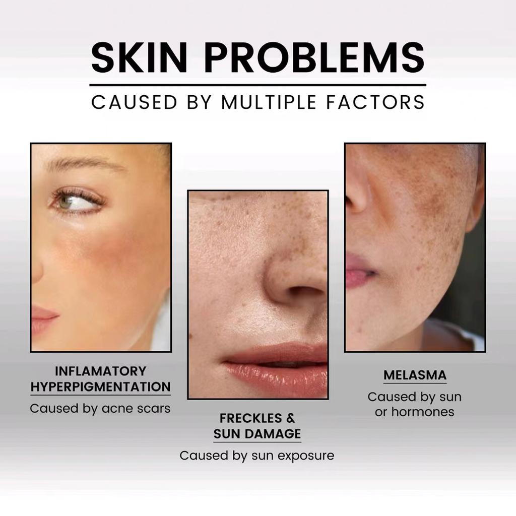 Krém proti vráskám Zpevňující Lifting Obličej Krk Proti stárnutí Odstraňte jemné linky Noční Denní Hydratační bělící péče o pleť