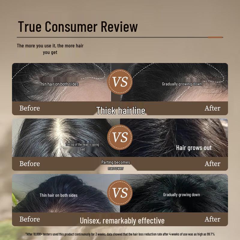 RUYI Hair Growth & Anti-Hair Loss Scalp Essence