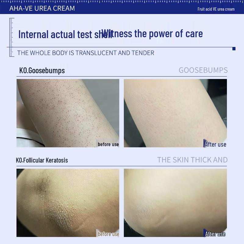 DAGO Fruit Acid VE Urea Body Cream