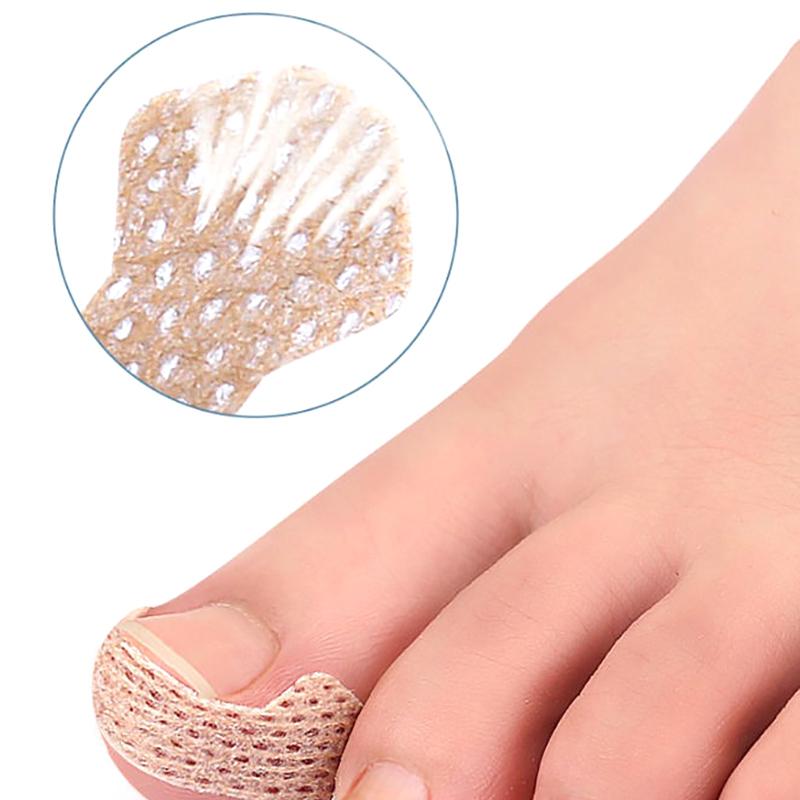 60Pcs Ingrown Paronychia Toenail Corrector Strips Anti Nail Patch Feet Sleeping Nail Patch Nails Into The Flesh Long Toe Pad