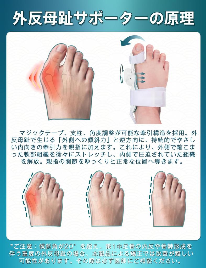 TOUKAWA Hallux Valgus Single Adjustable Includes Heel One Size Fits Suitable for Both Left and Right Spreads For Sleeping and Home Use Support,