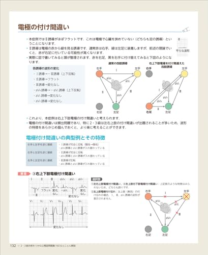 160 ECG Questions & Thorough Explanations To Pass Level 2 & 3 Exams - Get Stronger for the Actual Exam with Randomly Selected Practice Questions and P