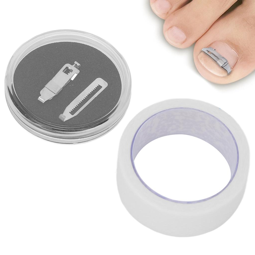 Ingrown Toenail Corrector Stainless Steel Paronychia Correction Tool with Adhesive Tape for Toenail Correction