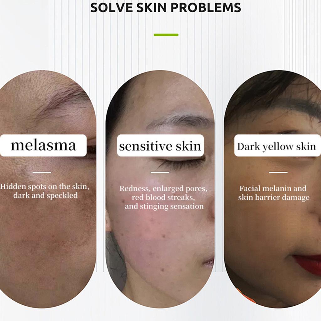 Feuchtigkeitsspendende Körpercreme reduziert Mattheit unter den Achseln, an Knien und Ellbogen und hellt den Teint auf.