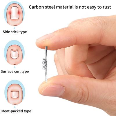 1 Stück Eingewachsener Zehennagel Korrektur Werkzeug Unsichtbarer Eingewachsener Zehennagel Elastischer Richtclip Klammer Pediküre Werkzeug