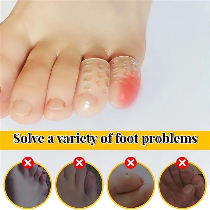 20 Peças Protetores de Dedo de Silicone Transparentes Respiráveis Previnem Bolhas, Calos e Calosidades, Confortáveis Com Alta Elasticidade