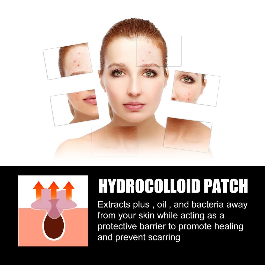 Large Capacity Pimple Patches, Colorful Cute Zit Covers,Hydrocolloid Acne Patches With Tea Oil, Witch Hazel, Centella Asiatica , Hyaluronic Sour