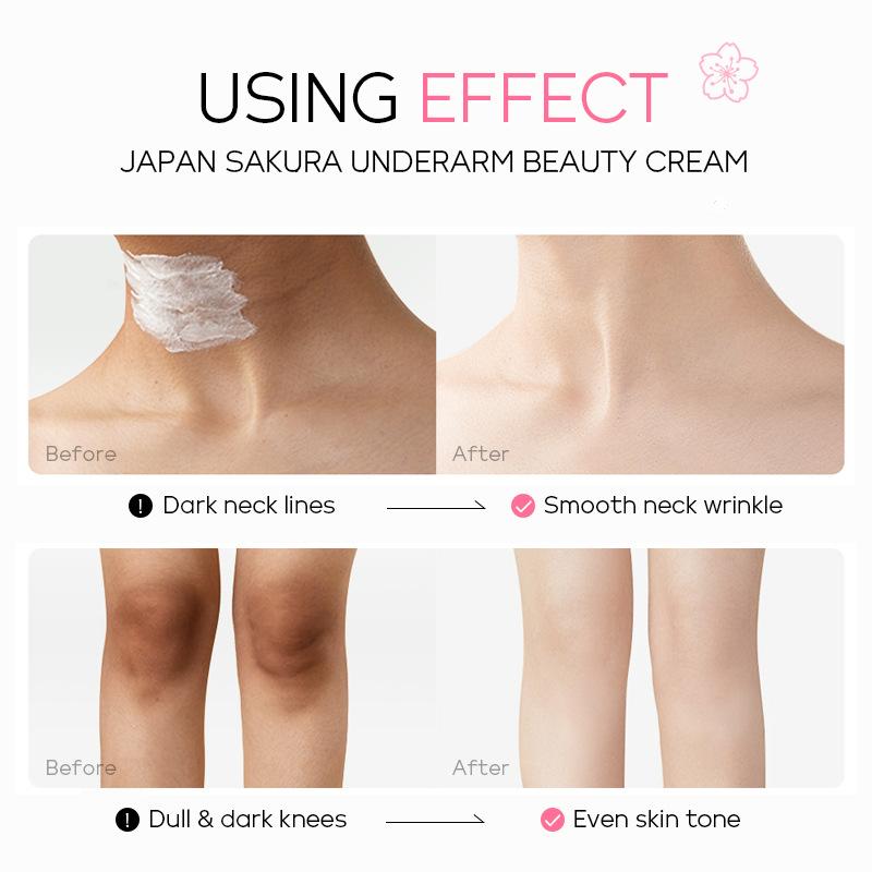LAIKOU Crème d'haltérophilie aux fleurs de sakura japonais pour les aisselles, éclaircissement de la peau foncée des genoux et des hanches, amélioration des dépôts de mélanine et teint terne