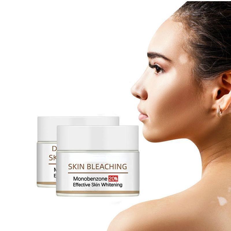 Skin Whitening Cream Fade Dark Spots White Spots Black Skin Monobenzon Bleaching Cream
