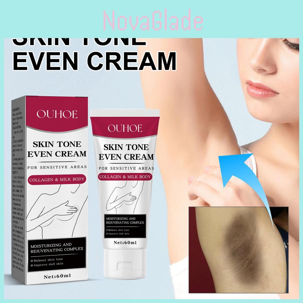 Strahlende Aufhellende Hautcreme Für Achseln Ellenbogen Gelenke Dunkle Flecken Nährender Feuchtigkeitsspender