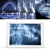 AC110- Przeglądarka zdjęć dentystycznych Podświetlarka LED z uchwytem Klips do mocowania zdjęć