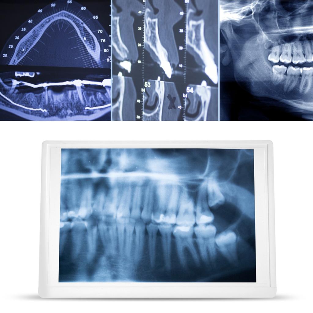 AC110- Przeglądarka zdjęć dentystycznych Podświetlarka LED z uchwytem Klips do mocowania zdjęć