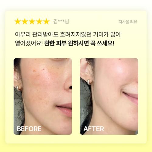 Frankly Vitamin C 23 Serum 15ml