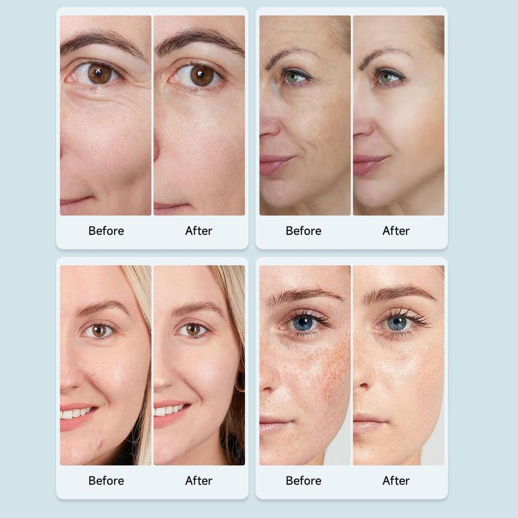 Beauty Led Mask, Led Face Mask Light Therapy