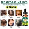 Liquide anti-chute de cheveux pour hommes et femmes Huile essentielle raffermissante pour les cheveux Essence nourrissante réparatrice pour les cheveux Liquide de croissance des cheveux