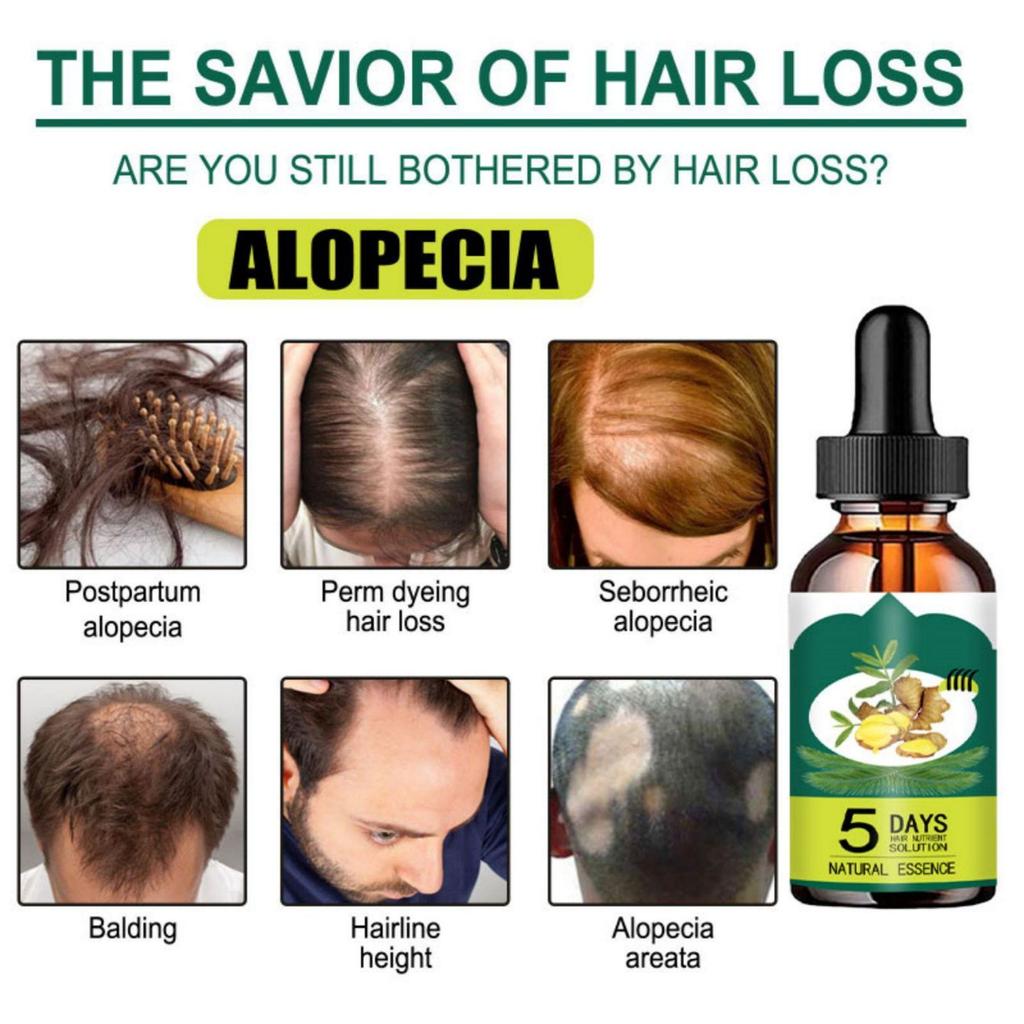 Liquide anti-chute de cheveux pour hommes et femmes Huile essentielle raffermissante pour les cheveux Essence nourrissante réparatrice pour les cheveux Liquide de croissance des cheveux