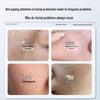 Zhihuilu Blackhead Removal & Pore Cleansing Kit