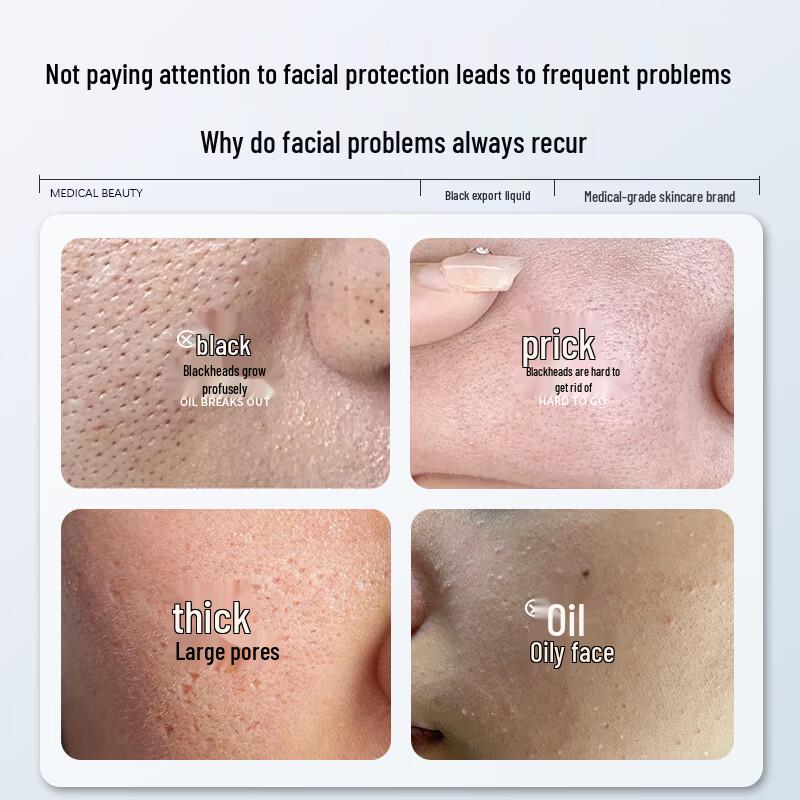 Zhihuilu Blackhead Removal & Pore Cleansing Kit