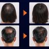 [TSJ BIO] NMN Hair Tonic 100ml