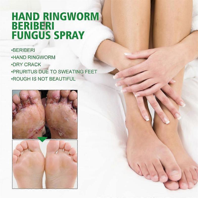 Athletes Foot Spray,Athletes Foot Treatment Spray,Foot Fungal Treatment,Athletes Foot Remedies,Effective Foot Odour Spray