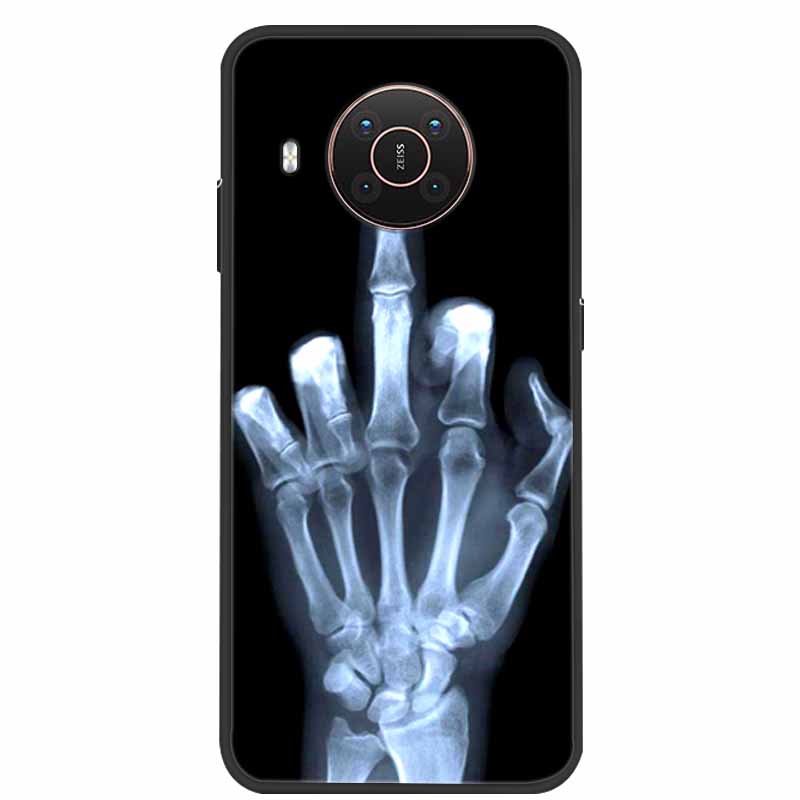 Per Nokia X20 X10 Custodia Moda Morbida Silicone TPU Custodia Telefono Per Nokia G50 X100 5G Copertura Posteriore Funda Coque NokiaX20 X 10 G50 5G